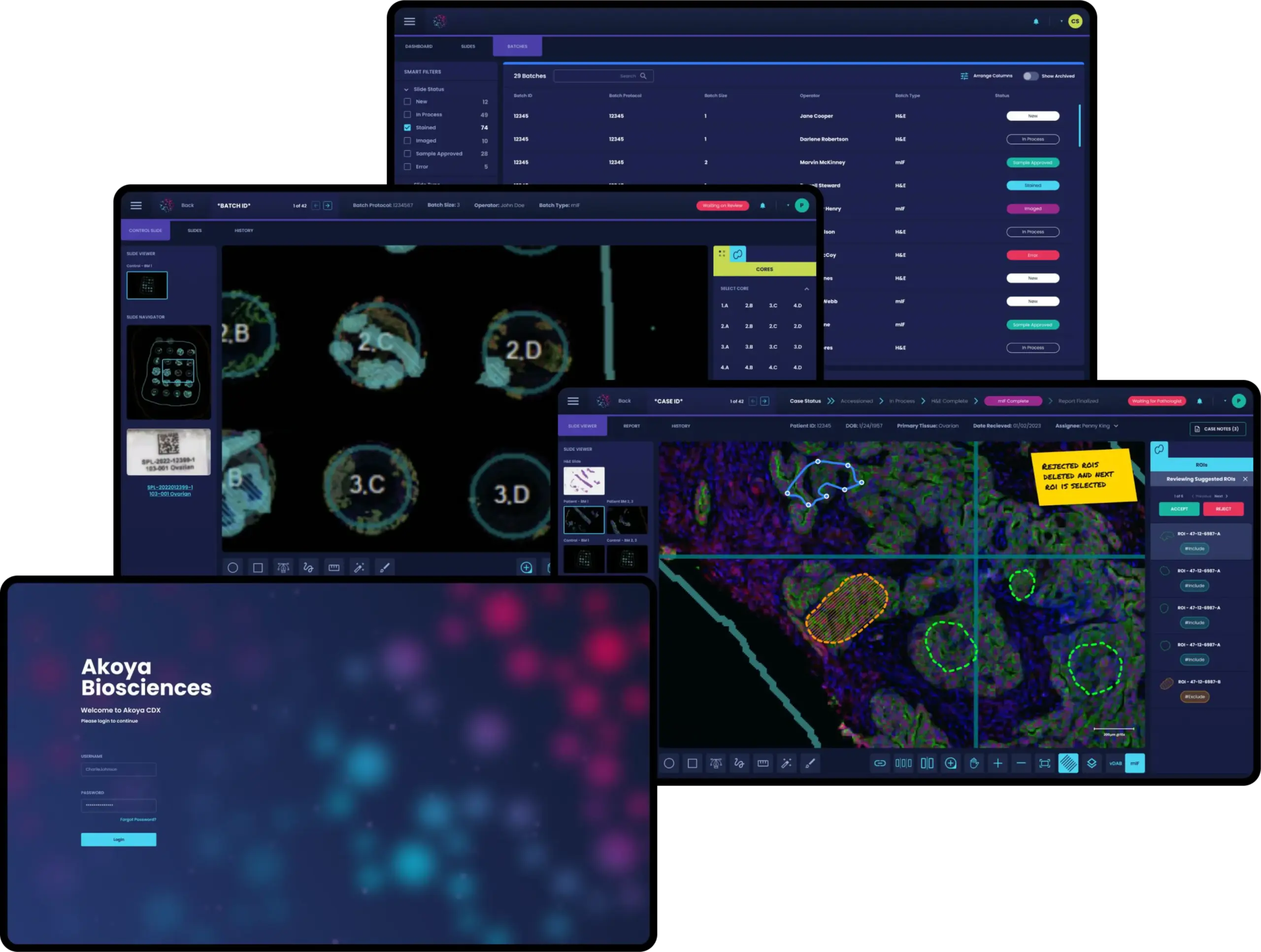 Akoya Biosciences clinical interface MVP showing batch management, medical imaging viewer, and tissue sample analysis designed by unosquare