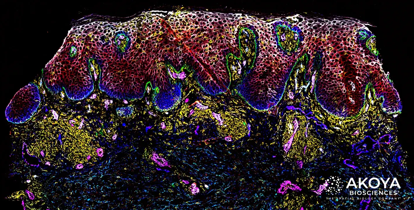 AI-powered Tumor Technology | MVP Design
